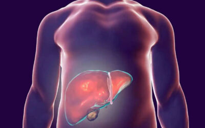 It Is Possible To Reverse Fatty Liver Disease; Here’s How
